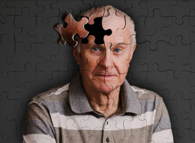 阿尔兹海默症是老年痴呆吗