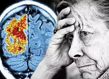 老年痴呆和脑萎缩区别