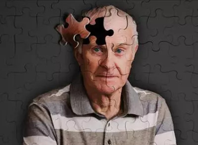 老年痴呆病早期的四个临床表现